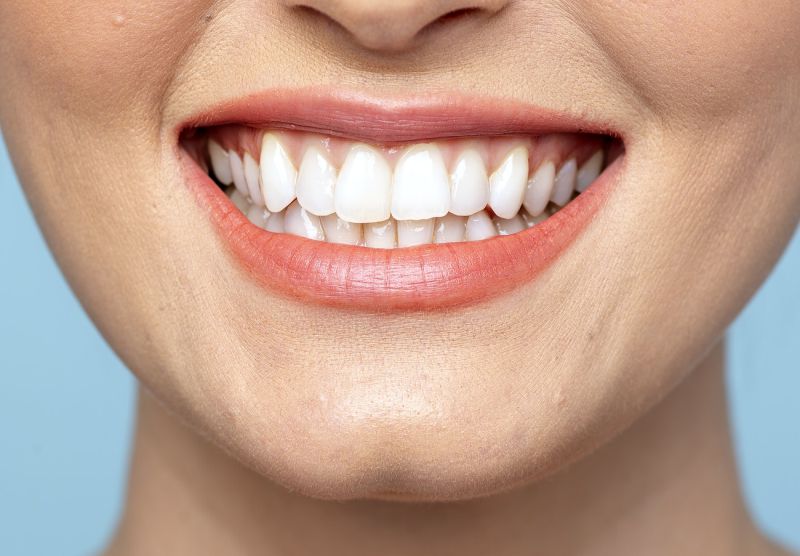 dentista lente contato